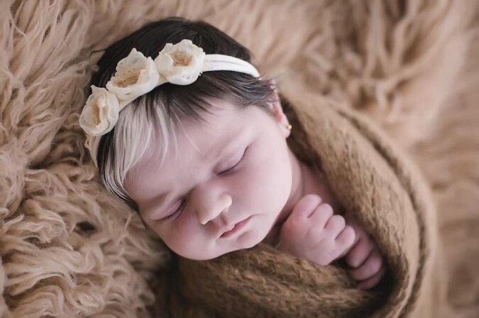 "Mini-Cruella": Das Baby wurde mit einer seltenen Haarfarbe geboren