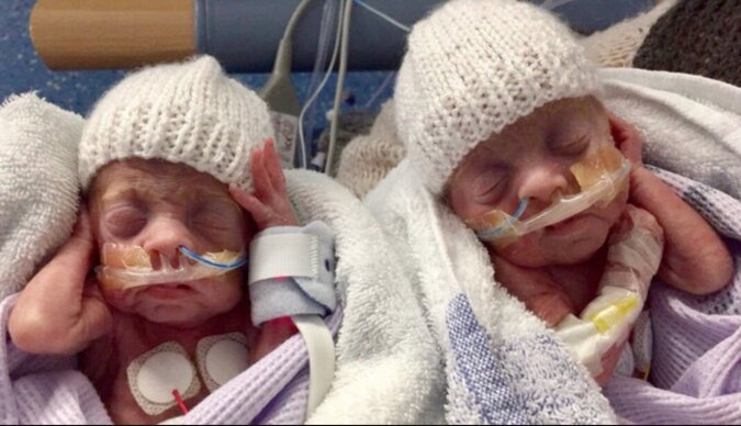 Die Zwillinge, die in Woche 24 geboren wurden, überlebten entgegen den Vorhersagen