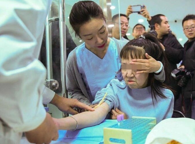 Eine 15-jährige Chinesin wurde in der Schule mit den Eltern der Kinder verwechselt: eine Operation hat alles verändert