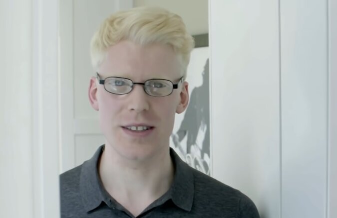 Junge mit Albinismus. Quelle: YouTube Screenshot
