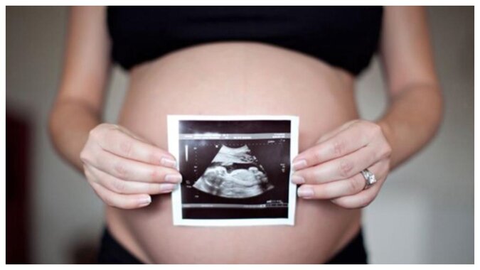 Eine Frau mit einem Ultraschallbild ihres Babys im Mutterleib. Quelle: laykni.com