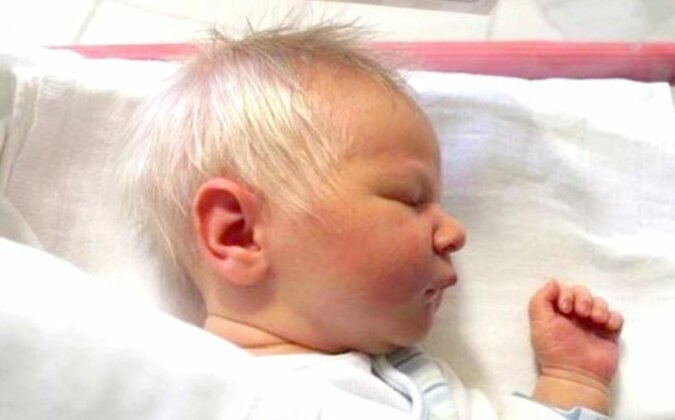 Als das Baby mit grauen Haaren geboren wurde, waren nicht nur Eltern, sondern auch Ärzte überrascht